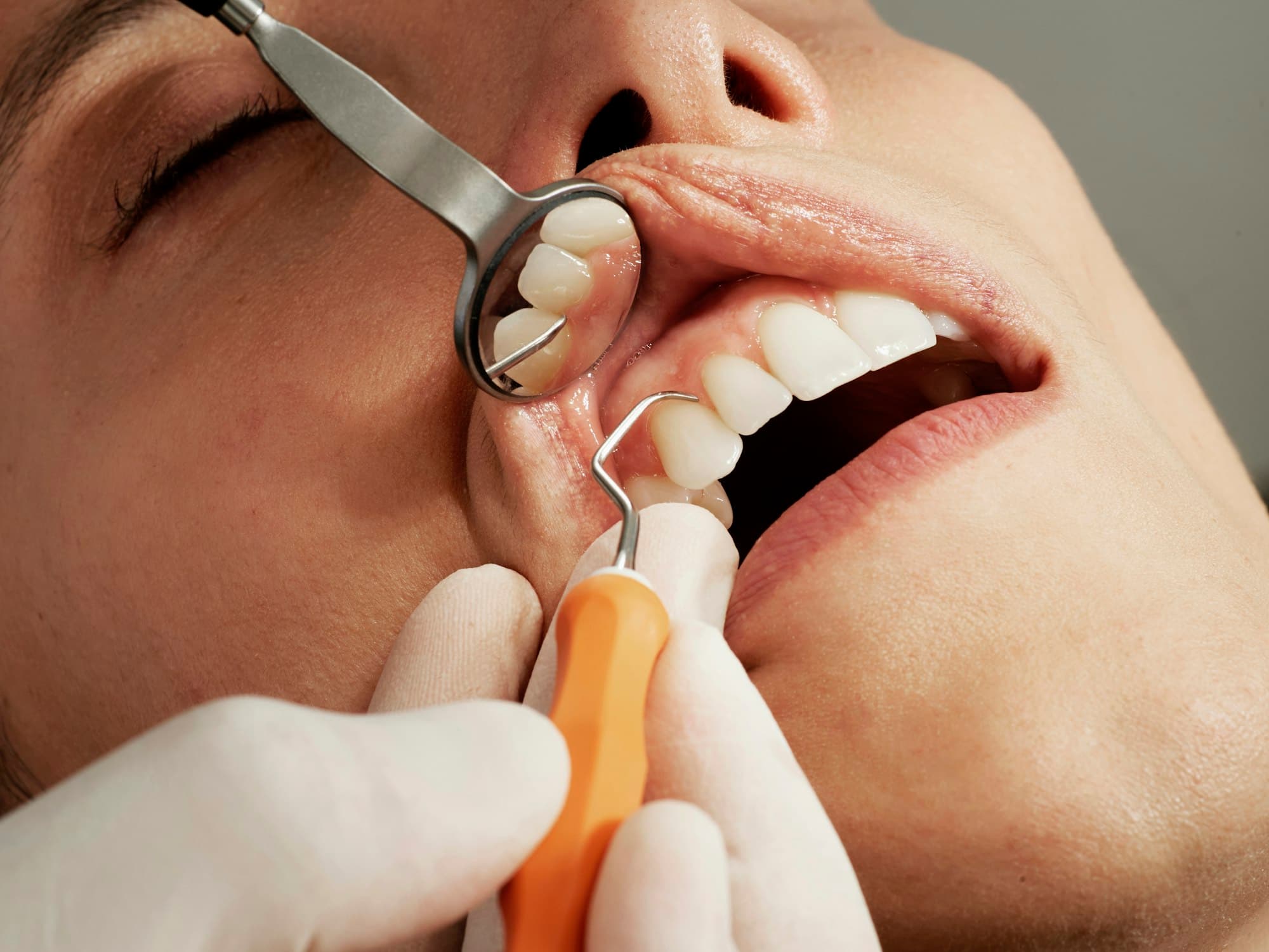 Close detail of a dental examination demonstrating clinical precision